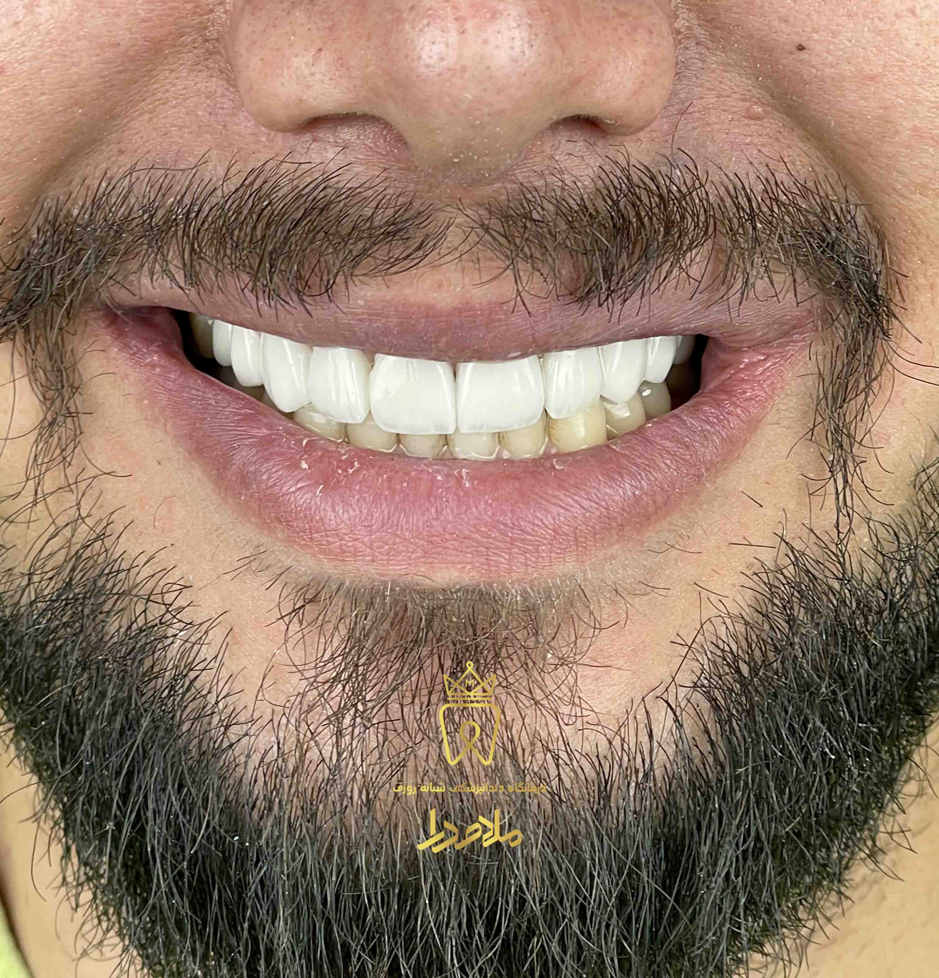 لمینیت